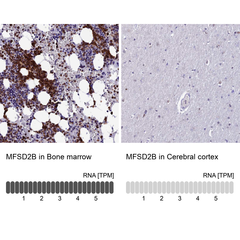 Anti-MFSD2B Antibody