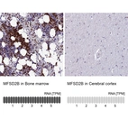 Anti-MFSD2B Antibody