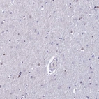 Immunohistochemical staining of human cerebral cortex shows low expression as expected.