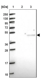 Lane 1: Marker [kDa] 250, 130, 95, 72, 55, 36, 28, 17, 10_br/_Lane 2: Human cell line RT-4_br/_Lane 3: Human cell line U-251MG sp