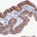 Immunohistochemical staining of human Fallopian tube shows moderate cytoplasmic positivity in glandular cells.