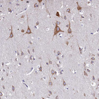 Immunohistochemical staining of human cerebral cortex shows moderate granular cytoplasmic positivity in neurons.