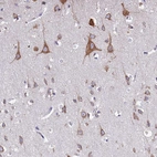 Immunohistochemical staining of human cerebral cortex shows moderate granular cytoplasmic positivity in neurons.