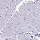 Immunohistochemical staining of human skeletal muscle shows no positivity in myocytes as expected.