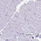 Immunohistochemical staining of human skeletal muscle shows no positivity in myocytes as expected.
