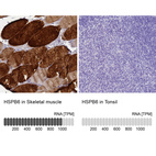 Anti-HSPB6 Antibody