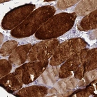 Immunohistochemical staining of human skeletal muscle shows high expression.