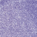 Anti-HSPB6 Antibody