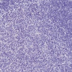 Immunohistochemical staining of human tonsil shows low expression as expected.