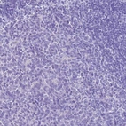 Immunohistochemical staining of human tonsil shows low expression as expected.