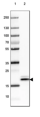 Lane 1: Marker [kDa] 250, 130, 100, 70, 55, 35, 25, 15, 10_br/_Lane 2: Human Skeletal muscle tissue