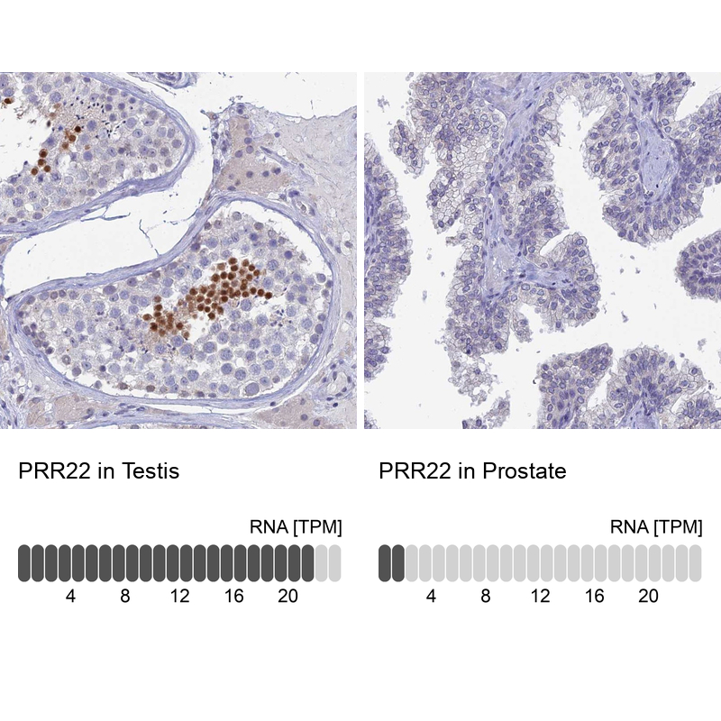 Anti-PRR22 Antibody
