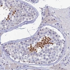 Immunohistochemical staining of human testis shows high expression.