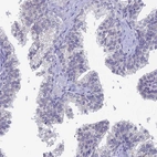 Immunohistochemical staining of human prostate shows low expression as expected.