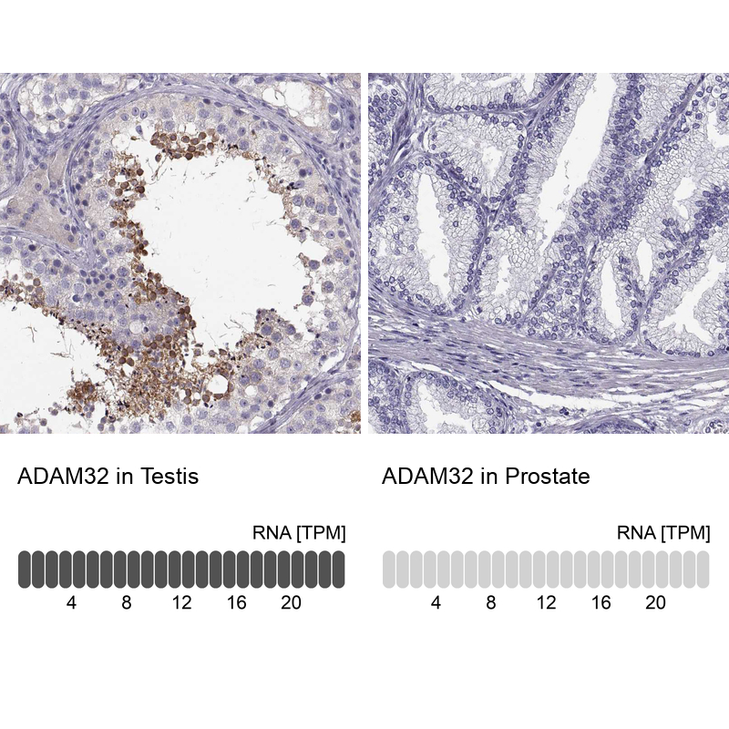 Anti-ADAM32 Antibody