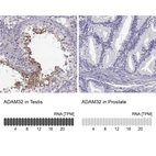 Anti-ADAM32 Antibody