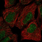 Immunofluorescent staining of human cell line HEK 293 shows localization to nucleus & vesicles.