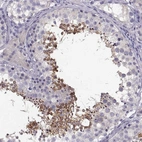 Immunohistochemical staining of human testis shows strong membranous and cytoplasmic positivity in spermatids.