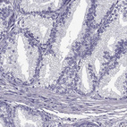 Immunohistochemical staining of human prostate shows no positivity in glandular cells as expected.