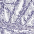 Immunohistochemical staining of human prostate shows no positivity in glandular cells as expected.