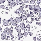 Immunohistochemical staining of human placenta shows no positivity in trophoblastic cells as expected.
