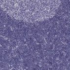 Immunohistochemical staining of human tonsil shows no positivity in non-germinal center cells as expected.