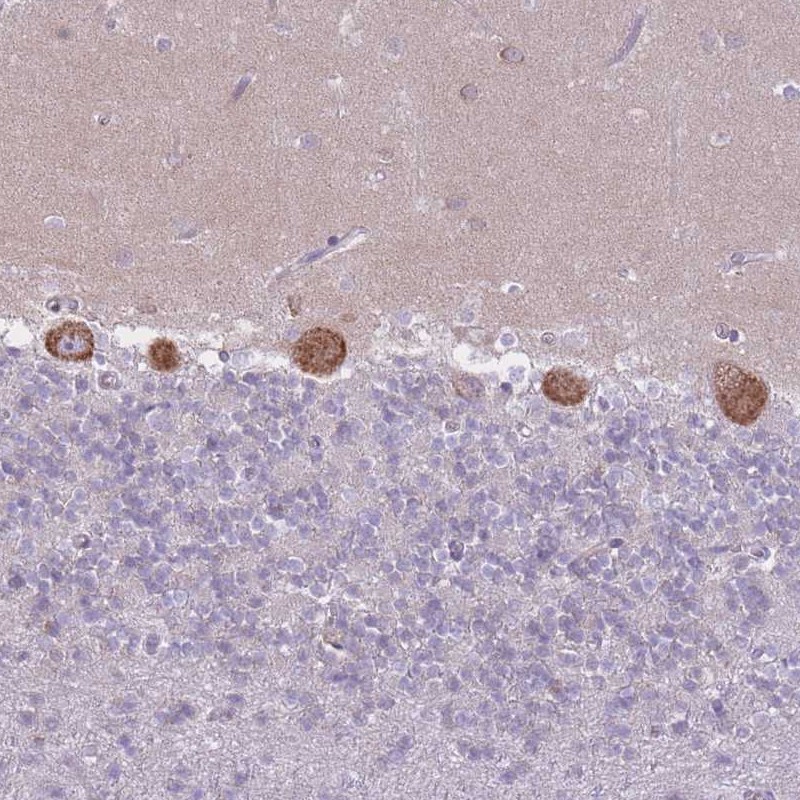 Anti-ZNF501 Antibody