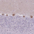 Anti-ZNF501 Antibody