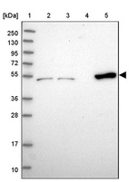 Lane 1: Marker [kDa] 250, 130, 95, 72, 55, 36, 28, 17, 10_br/_Lane 2: Human cell line RT-4_br/_Lane 3: Human cell line U-251MG sp_br/_Lane 4: Human plasma (IgG/HSA depleted)_br/_Lane 5: Human liver tissue