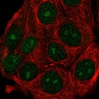 Immunofluorescent staining of human cell line MCF7 shows localization to nucleus & nucleoli.