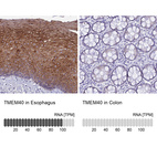 Anti-TMEM40 Antibody