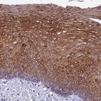 Immunohistochemical staining of human esophagus shows high expression.