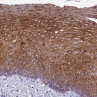 Anti-TMEM40 Antibody