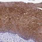 Immunohistochemical staining of human esophagus shows high expression.