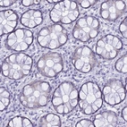 Immunohistochemical staining of human colon shows low expression as expected.