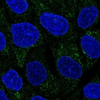 Immunofluorescent staining of human cell line RT4 shows localization to cytosol.