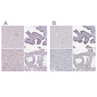 Anti-NHP2 Antibody