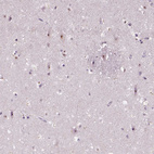 Immunohistochemical staining of human cerebral cortex shows moderate nucleoli positivity in neurons.