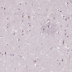 Immunohistochemical staining of human cerebral cortex shows moderate nucleoli positivity in neurons.