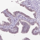 Immunohistochemical staining of human fallopian tube shows moderate nucleoli positivity in glandular cells.