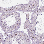 Anti-NHP2 Antibody