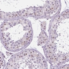 Immunohistochemical staining of human testis shows moderate nucleoli positivity in cells in seminiferous ducts.