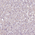 Anti-NHP2 Antibody