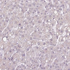 Immunohistochemical staining of human liver shows no nuclear positivity in hepatocytes as expected.