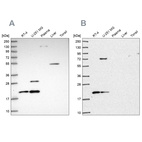 Anti-NHP2 Antibody