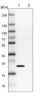 Lane 1: NIH-3T3 cell lysate (Mouse embryonic fibroblast cells)_br/_Lane 2: NBT-II cell lysate (Rat Wistar bladder tumour cells)