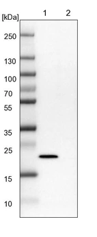 Lane 1: NIH-3T3 cell lysate (Mouse embryonic fibroblast cells)_br/_Lane 2: NBT-II cell lysate (Rat Wistar bladder tumour cells)