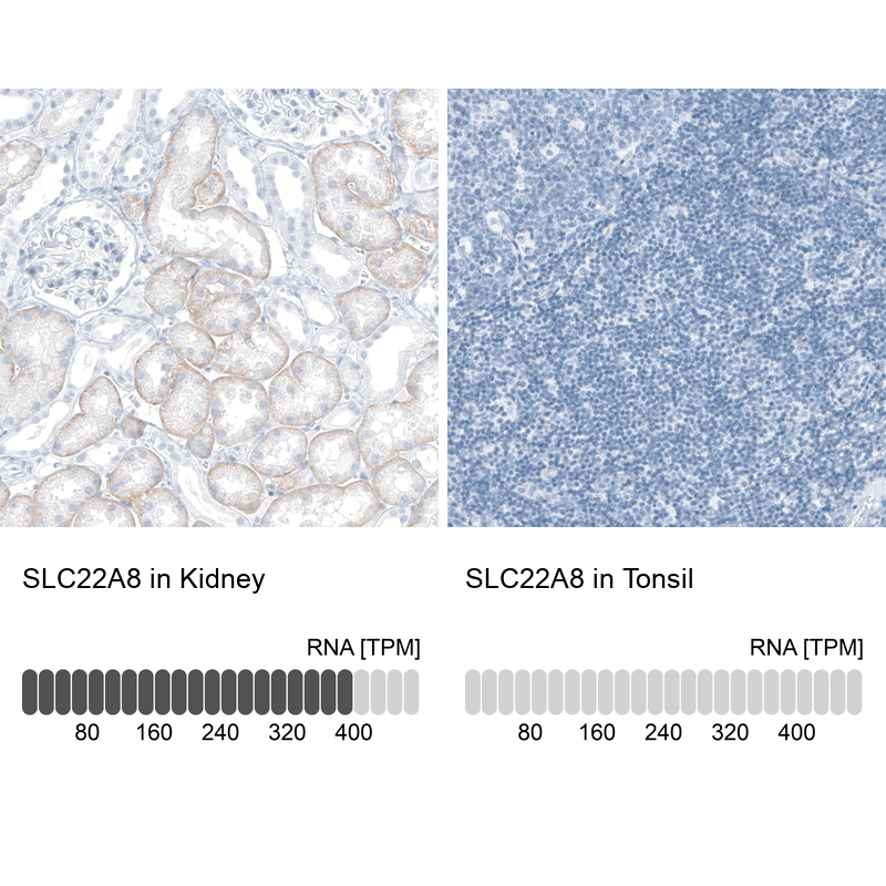 Anti-SLC22A8 Antibody