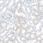Immunohistochemical staining of human Kidney shows moderate positivity in basolateral membrane in cells in tubules.