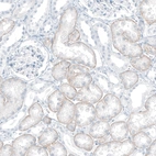 Immunohistochemical staining of human Kidney shows moderate positivity in basolateral membrane in cells in tubules.